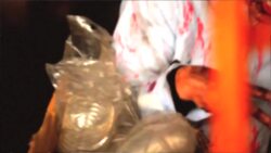 Diseases That Could Become Zombie Sicknesses Instructional Video