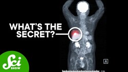 How PET Scans See Cancer Instructional Video