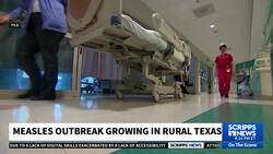 Measles outbreak underway in rural Texas News Clip