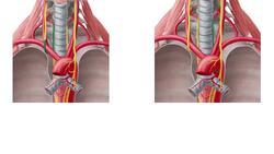 Nerves of the parapharyngeal space Instructional Video