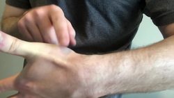 Scaphoid Fracture Test (Clinical Exam) and the Anatomic Snuffbox Instructional Video