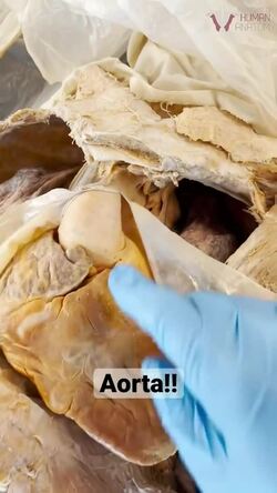 The Importance of the Aorta: The Largest Artery in the Human Body Instructional Video