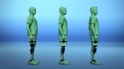 New bionic limb use electrodes, sensors for sensation Instructional Video