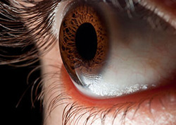 Dominant allele Instructional Video