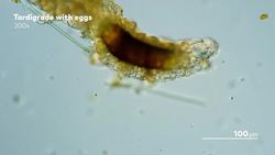 Looking at Tardigrade Sperm and Other Reproducing Swimmers Instructional Video