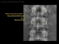 Anatomy of a Lumbar x-ray Instructional Video