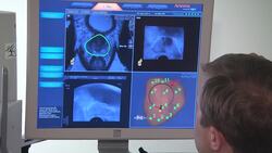 American Cancer Society: 1 in 8 men will be diagnosed with prostate cancer News Clip