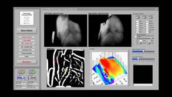 Watch this robot draw blood from a patient Instructional Video