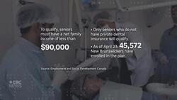 Questions about Canada’s national dental care plan? Here’s what we know News Clip