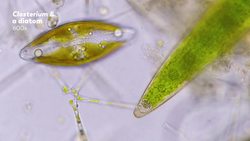 Mysterious Jiggly Crystals and Other Intracellular Structures Instructional Video