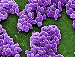 Células: tipos de células Instructional Video