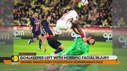 PSG's Donnarumma Leaves Field After Brutal Boot To The Face News Clip