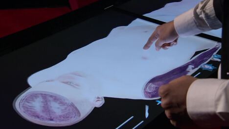 TED: On the virtual dissection table | Jack Choi