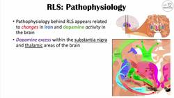Restless Legs Syndrome (RLS) | Causes, Signs & Symptoms, Diagnosis, Treatment Instructional Video