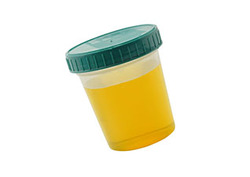 Urea Instructional Video