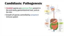 Candidal (Yeast) Infections Overview | Oral Thrush, Vaginal, Intertrigo, Esophageal Candidiasis Instructional Video