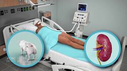 Doctors successfully attach pig’s kidney to human News Clip