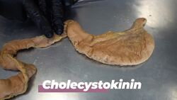 The Anatomy and Function of the Gallbladder Instructional Video