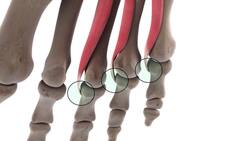 Central plantar muscles of the foot (3D) Instructional Video