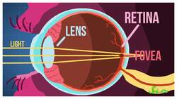 Why Does Squinting Help You See Better? Instructional Video