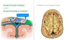 Superior sagittal sinus level Instructional Video