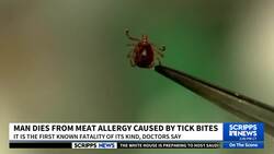 The 47-year-old died after eating a hamburger at a barbecue. News Clip