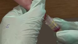 CLEAN : London clinic tests for coronavirus antibodies News Clip