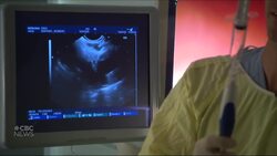 Province supports more medical diagnostic procedures in Windsor News Clip