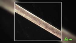 Will Stress Really Make You Go Gray? Instructional Video