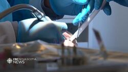 Nova Scotia Dental Association welcomes changes to CDCP News Clip