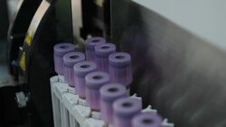 Covid testing lab News Clip