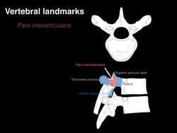Vertebral landmarks Instructional Video