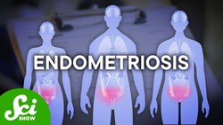 You Don’t Need A Uterus to Get A Uterine Disease Instructional Video