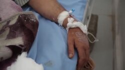 CLEAN : Yemeni patients recover in a hospital after swine flu outbreak News Clip