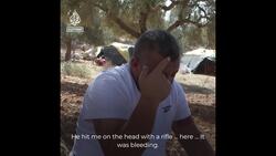 Palestinian activist attacked in the occupied West Bank News Clip