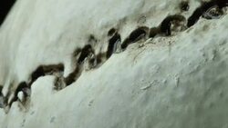 Human Skull Analysis Stock Footage