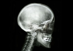 X-ray Instructional Video