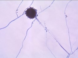 Fungi: the Imperfect Fungi Instructional Video