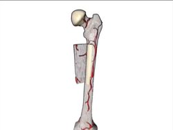 Skin, Skeletal, and Muscular Systems: Bone and Cartilage Instructional Video