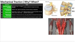 Mechanical Traction [Part 1] | Theory, Indications & Contraindications Instructional Video