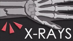 Why and how do we use X-rays in medicine Instructional Video