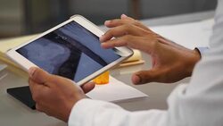 Unrecognizable doctor reviews patient's foot x-ray on digital tablet Stock Footage