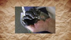 What Was It Like To Be A Body Collector During The Black Plague? Instructional Video