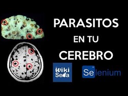 Neurocisticercosis, que provoca? | con Wikiseba Instructional Video