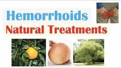 How To Treat Hemorrhoids | 9 Natural Treatments (Plant Flavonoids) for Hemorrhoidal Disease Instructional Video