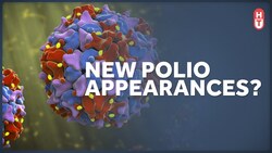 A Polio Case in the United States. What Does it Mean? Instructional Video