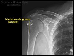 Anatomy of Shoulder X-rays Instructional Video