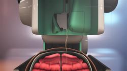 Elon Musk’s brain chip: How it works Instructional Video