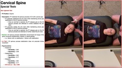 Alar Ligament Stress Test (with Rotation & Sidebending) | Demonstration & Interpretation Instructional Video