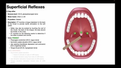 Gag Reflex | Procedure & Results Interpretation Instructional Video